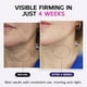 thumbnail image 2 of Crema reafirmante para cuello y escote GOOSURE con retinol 125 ml, 2 of 7