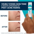 thumbnail image 2 of Serum Cerave Anti-Imprefecciones con Retinol para piel Grasa 30 ml, 2 of 6