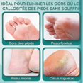 thumbnail image 4 of 2026 Electric Foot Scraper, Foot Scraper Electric Foot File With 3 Rollers, 2 Speeds Rechargeable Pedicure Foot File For Anti Calluses, 4 of 5