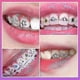 thumbnail image 2 of Tooth Gem Set DIY Crystal Jewelry Tools Safe and Non Damaging, 2 of 5