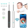 thumbnail image 1 of 1080p Wi-fi Visible Wax Elimination Spoon Usb Hd Load Otoscope, 1 of 4