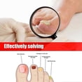 thumbnail image 4 of Nail Fungas Treatmant for Toenail - Toenail Fungul Treatmant Extra Strong - Toe Nail Fungas Treatmet - Anti fungas Nail Repeir and Strengthen, Fix & R, 4 of 5