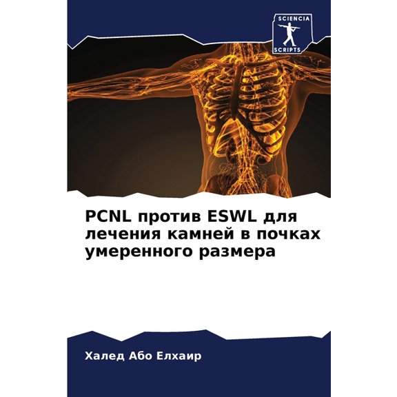 Pcnl против Eswl для лечени, (Paperback)