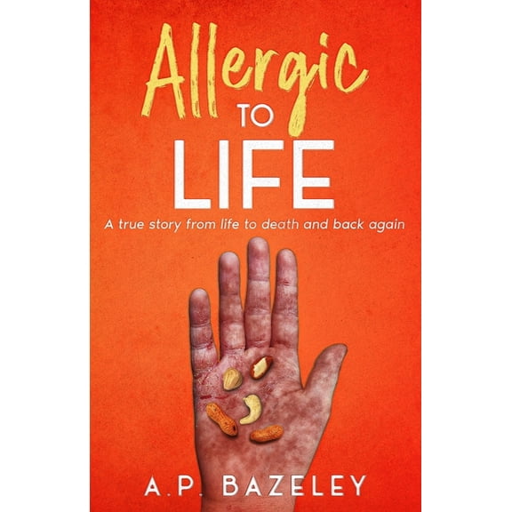 Allergic To Life, (Paperback)