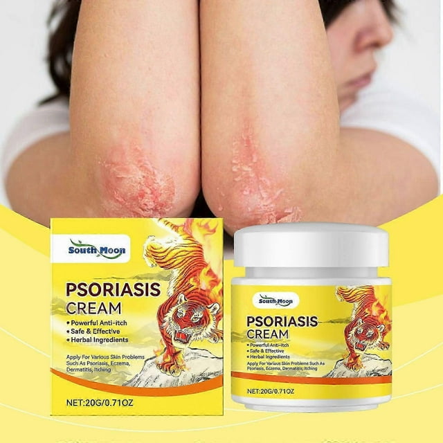 Psoriasis & Eczema Relief Cream Anti-Itch, Soothing & Moisturizing with Allantoin & Natural Extracts for Sensitive Skin