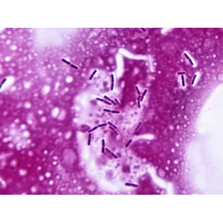 Lactobacillus Bulgaricus Bacteria in Yogurt Print Wall