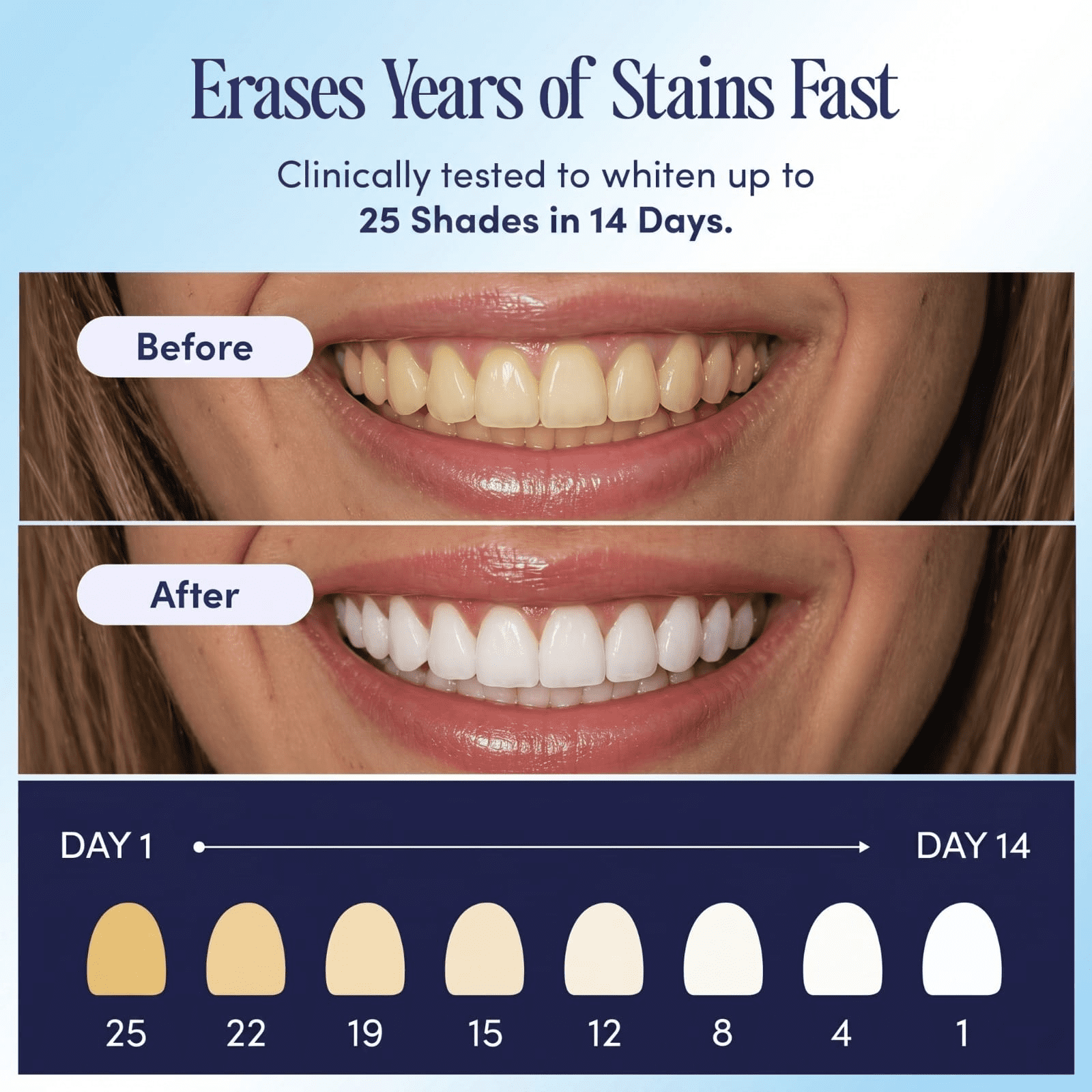 Boca Bella Teeth Whitening U-Wraps – 10 Treatments – 15% Hydrogen Peroxide, Enamel-Safe, No Harsh Sensitivity – Patented Strip Design with Aloe, Calendula & Peppermint – Fast, Even Whitening
