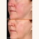thumbnail image 4 of Sérum Dr Dennis Gross con vitamina C láctica 15% 30 ml, 4 of 8