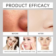 Kokovifyves White Rice Exfoliant Rice Ampoule White Rice Ampoule Rice Exfoliating Peeling Solution Moisturizing Pore for Face 100ml