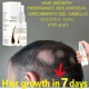thumbnail image 2 of Spray para el crecimiento del cabello, suero para el crecimiento de raíces del cabello, previene la calvicie, cuidado contra la pérdida de pelos, aceite para el crecimiento del cabello, más grueso y r, 2 of 5