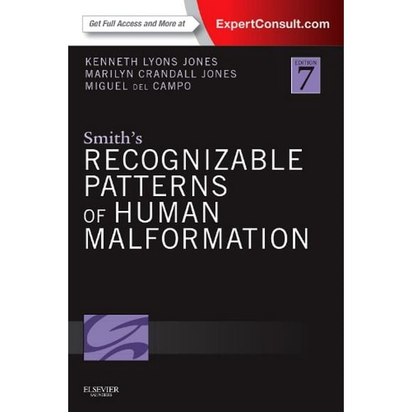 Smith's Recognizable Patterns of Human Malformation: Expert Consult - Online and Print