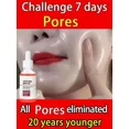 thumbnail image 4 of Suero Facial de ácido salicílico para reparación de poros grandes, antiarrugas, Control de aceite, blanqueamiento, cuidado de la piel, suero de contracción de poros, 4 of 5