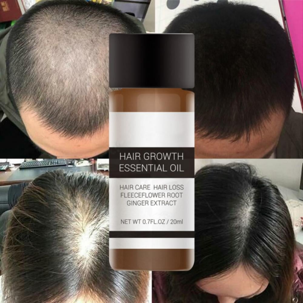 PRAETER 20ml Hair Growth Essential Oil Fleeceflower Root Ginger Extract  Treatment Against Hair Loss 