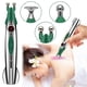 thumbnail image 2 of Electric Acupuncture Pen Meridian Therapy Massager for Muscle Pain Relief & Deep Tissue Stimulation, 2 of 5