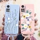 thumbnail image 4 of Funda trasera de silicona con cordón para Xiaomi Redmi Note 11, 11s, 11 Pro, 4 of 4