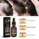thumbnail image 4 of Natural Hair Growth Serum for Stronger Thicker Longer Regrowth Prevent Hair Loss Treatment for Women, 4 of 5
