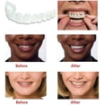 thumbnail image 2 of Carillas instantáneas JM Dentaduras postizas ajuste cómodo superior e inferior, 2 of 7