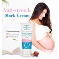 thumbnail image 2 of 1-3Pcs Anti-stretch Mark Cream For Pregnancy Repair Skin Mark Remover Body Lotion, 2 of 5