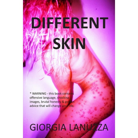 Different Skin, (Paperback)
