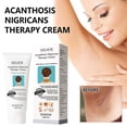 thumbnail image 4 of 3pcs Acanthosis Cream Nigrifix Cream For Acanthosis Nigricans Black Spot, 4 of 5