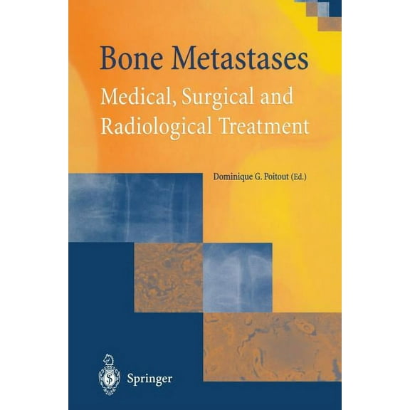 Bone Metastases: Medical, Surgical and Radiological Treatment, (Paperback)