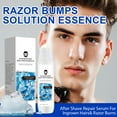 fake-teeth-dental-veneers-for-upper-and-lower-jaw-snap-on-veneers