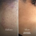 thumbnail image 3 of Champú para cuero cabelludo LolaVie Exfoliate & Detox 2 en 1, 180 ml, con carbón, 3 of 5