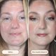 thumbnail image 4 of Sérum Concealer Live Tinted Hueskin de cobertura media a total, 4 of 6