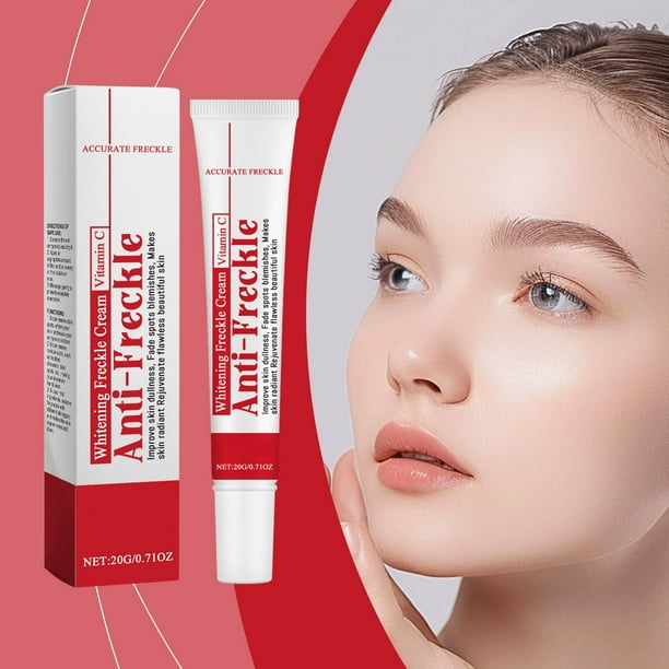 Crema blanqueadora de piel Anti pecas Corrector de manchas oscuras Rostro Iluminador Corporal Hidratante para Brazos Piernas Rodillas Codos Tratamiento de día y de noche Absorción rápida No graso