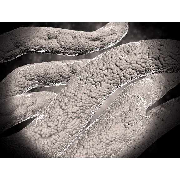 Microscopic view of corncob formation in dental plaque Canvas Art - Stocktrek Images (33 x 25)