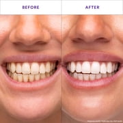 Hismile V34 Whitening Strips, Teeth Whitening Strips, Purple Whitening Strips