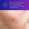 thumbnail image 3 of Steri Strips, Blend Tone, Skin Closures 1/2in x4 in, one pack of 6 Strips., 3 of 4