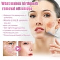 thumbnail image 5 of 1/2Pcs Birthmark Remover Oil Birthmark Lightening Oil, 5 of 5