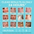 thumbnail image 4 of Almohadillas exfoliantes para el tratamiento del acné Neutralyze, 100 unidades, 4 of 6