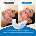 thumbnail image 5 of Anti-Snoring Mouth Guard, Snoring Solution - Helps Stop Snoring, Anti-Snoring Devices for Men/Women a Better Night's Sleep, 5 of 8