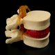 thumbnail image 5 of 2X Lumbar Vertebrae Model Anatomical Spine Lumbar Disc Herniation Anatomy Teaching Tool Lumbar Vertebrae Model, 5 of 5