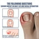 thumbnail image 3 of Líquido reparador de uñas de 10 ml Líquido eficaz para uñas Multiusos para el cuidado de los pies Ygjytge Cuidado Belleza, 3 of 8