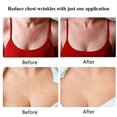 thumbnail image 5 of Graflsoa Transparent Silicone Anti-Wrinkle Lift Pads for Neck and Chest, Heart-Shaped Design, Lightweight and Comfortable, 5 of 5