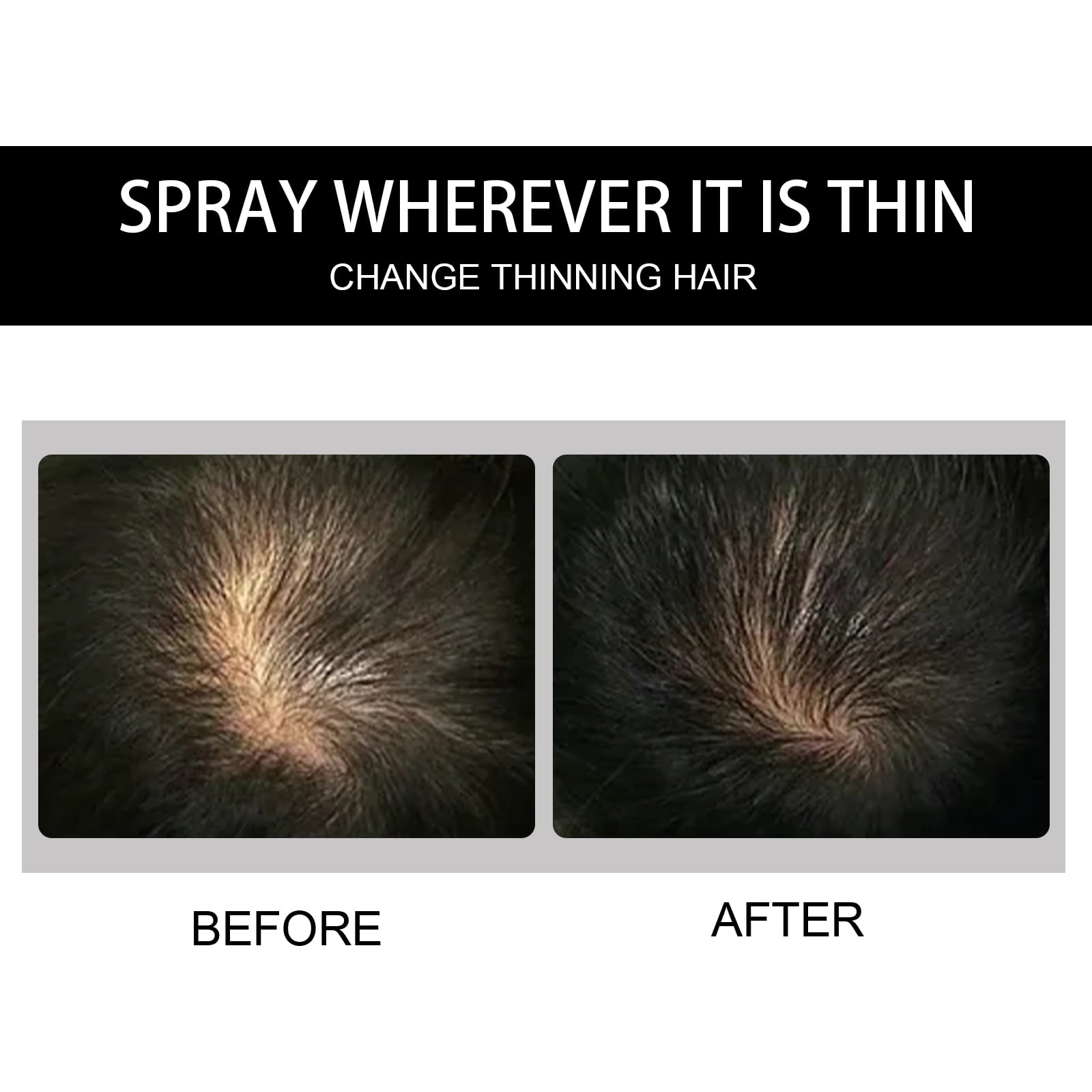 Alvantor Hair Building Fibers Powder for Thinning Hair, Black 0.42oz - Instant Volume & Coverage
