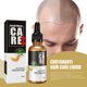 thumbnail image 5 of Aceite para el crecimiento del cabello, esencia eficaz para el cuidado del cabello, crecimiento saludable del cabello, más fuerte y más grueso, 5 of 5