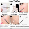 thumbnail image 2 of 4pcs Acne Removal Needle Set - Get Rid of Pimples & Blackheads Instantly!, 2 of 4