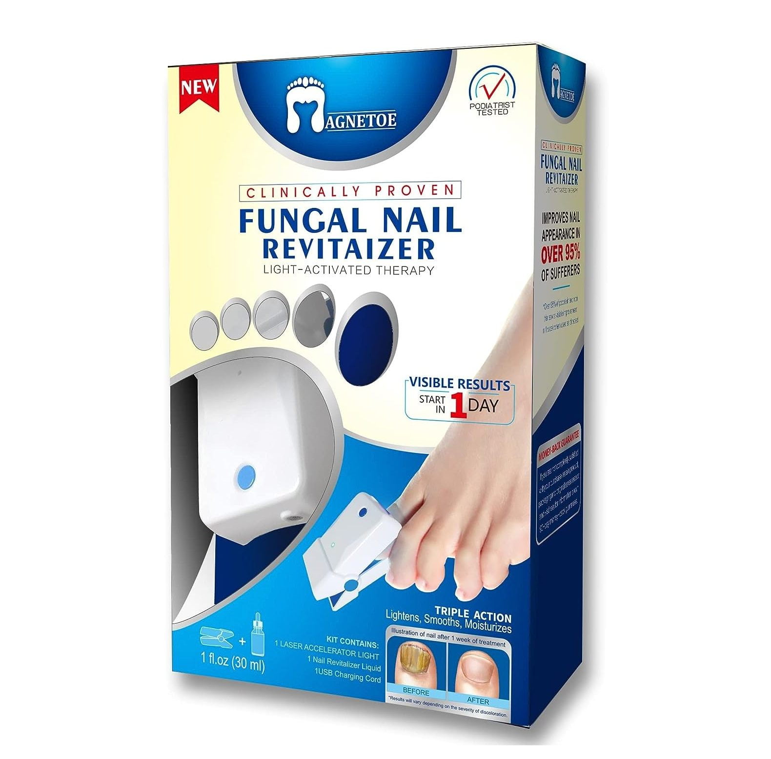Does Led Light Kill Nail Fungus Fungal Nail Treatment LED Light-Activated Therapy, Erase Toenail