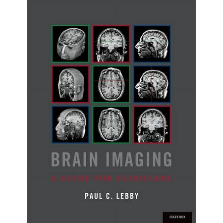 UPC: 9780190239060 | Brain Imaging: A Guide for Clinicians (Paperback)