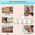 thumbnail image 2 of Set de ventosas DosensePro Silicone para masaje anticelulítico, 2 of 9
