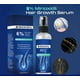 thumbnail image 5 of Spray para el crecimiento del cabello con minoxidil al 6 %, spray para el tratamiento del recrecimiento del cabello con minoxidil para un cabello más fuerte, más grueso y más largo, 5 of 5