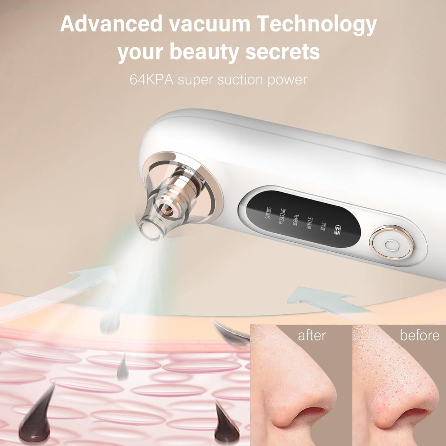 Blackhead Remover Vacuum Pore Extractor Kit - Blackhead Extractor Tool with 3 Adjustable Suction Levels, 5 Probes, USB Rechargeable, Suitable for Women and Men