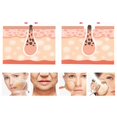 thumbnail image 4 of Skin Scrubber Machine Electric 3 Modes Pore Cleaner Facial Spatula Acne Remover, 4 of 10