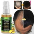thumbnail image 1 of Fiudx Aceite Revitalizante Capilar, Suero de Biotina para El Cuidado Capilar, Tratamiento Reparador Del Cuero Cabelludo, Control Del Frizz, Cuidado de Las Puntas Abiertas, Estimula El Crecimiento Del, 1 of 6