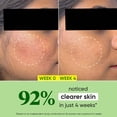 thumbnail image 3 of . & KEY CicaCalming Hydratant pour le Visage Sans Huile, 60 ml, 3 of 5