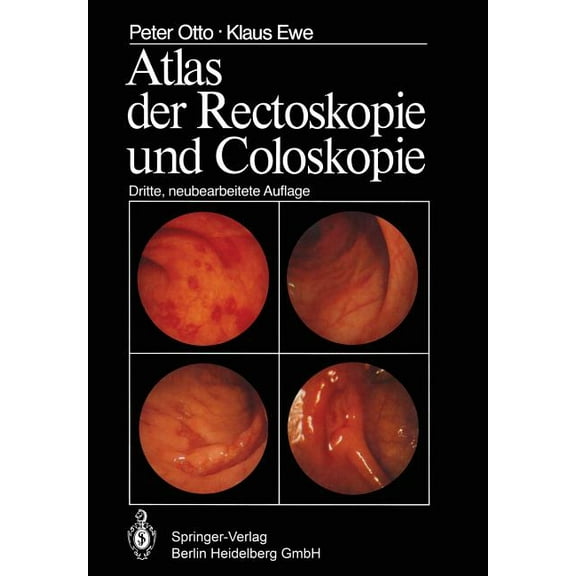 Atlas Der Rectoskopie Und Coloskopie, (Paperback)